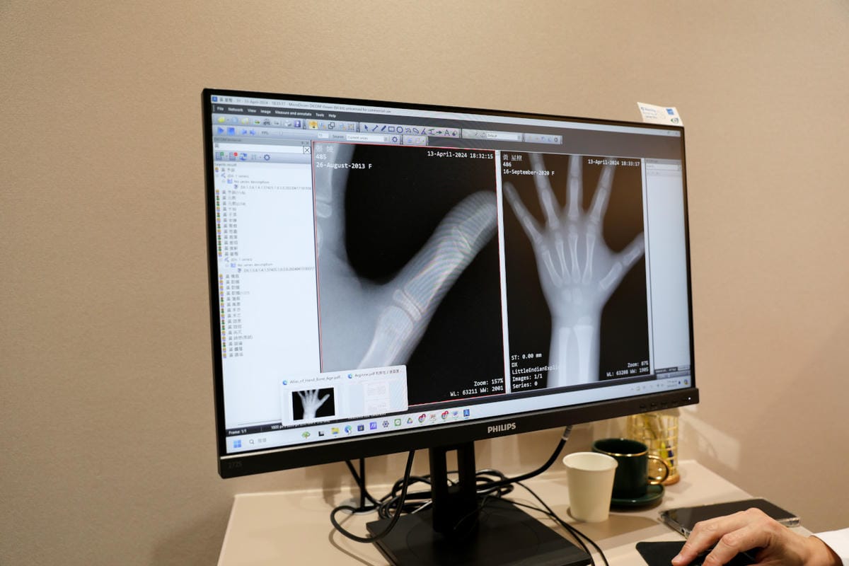 台北兒童成長門診推薦! 琢月診所/長高事務所 骨齡攝影檢查,身高異常矮小.性早熟治療